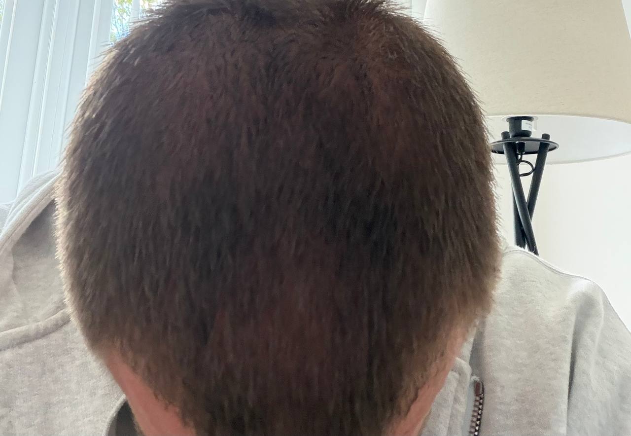 Field Notes: Five Weeks on the Hair Set